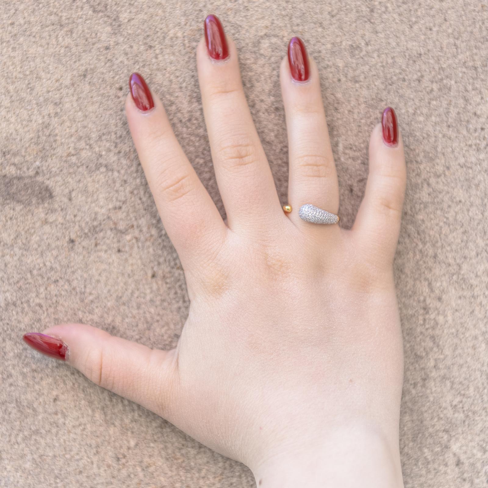 Anello Strascico